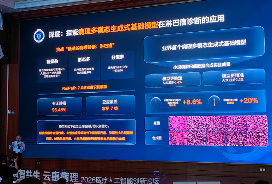 论坛幻灯片展示 RuiPath 2.0 淋巴瘤识别模型与 96.48% 准确率数据
