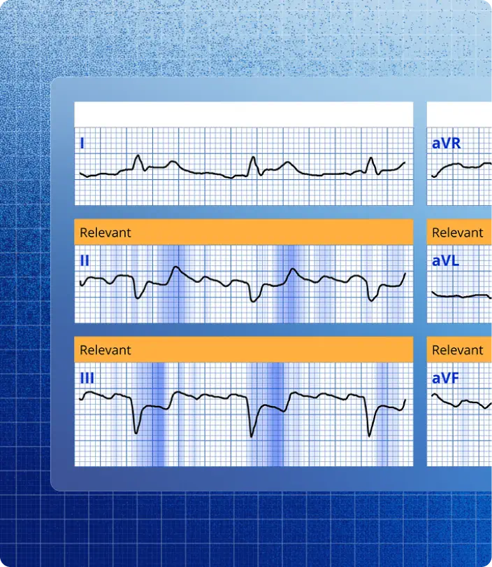 Queen of Hearts 的 ECGxplain 界面：在 ECG 导联波形上高亮标注「Relevant」片段